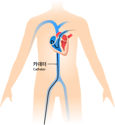 Heartartery